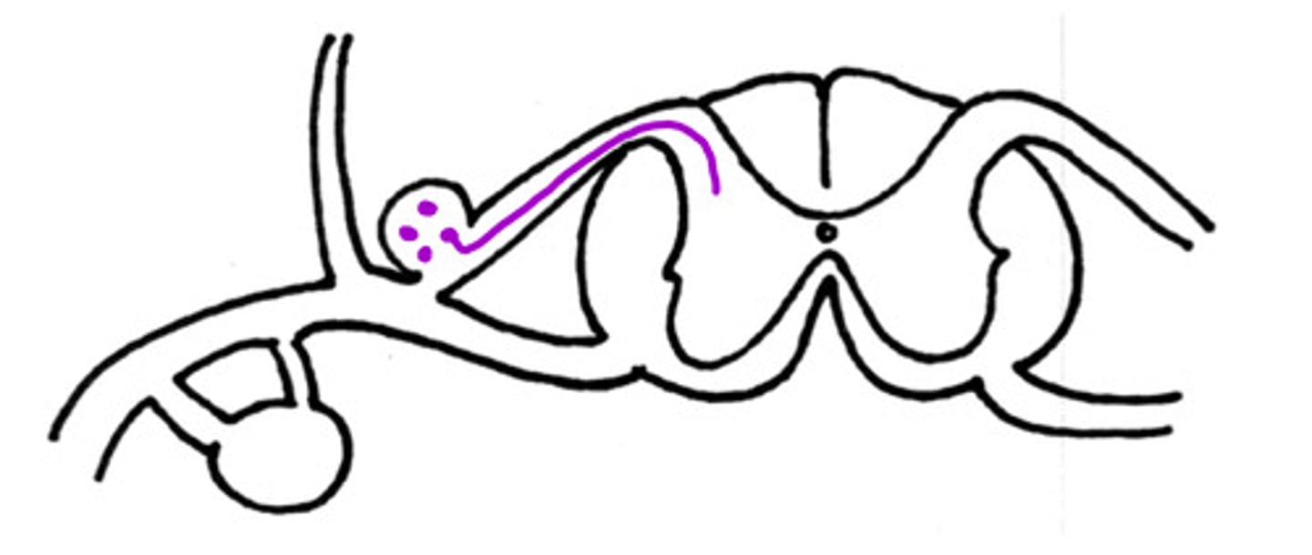 <p>Is this an example of a sensory of motor neuron</p>