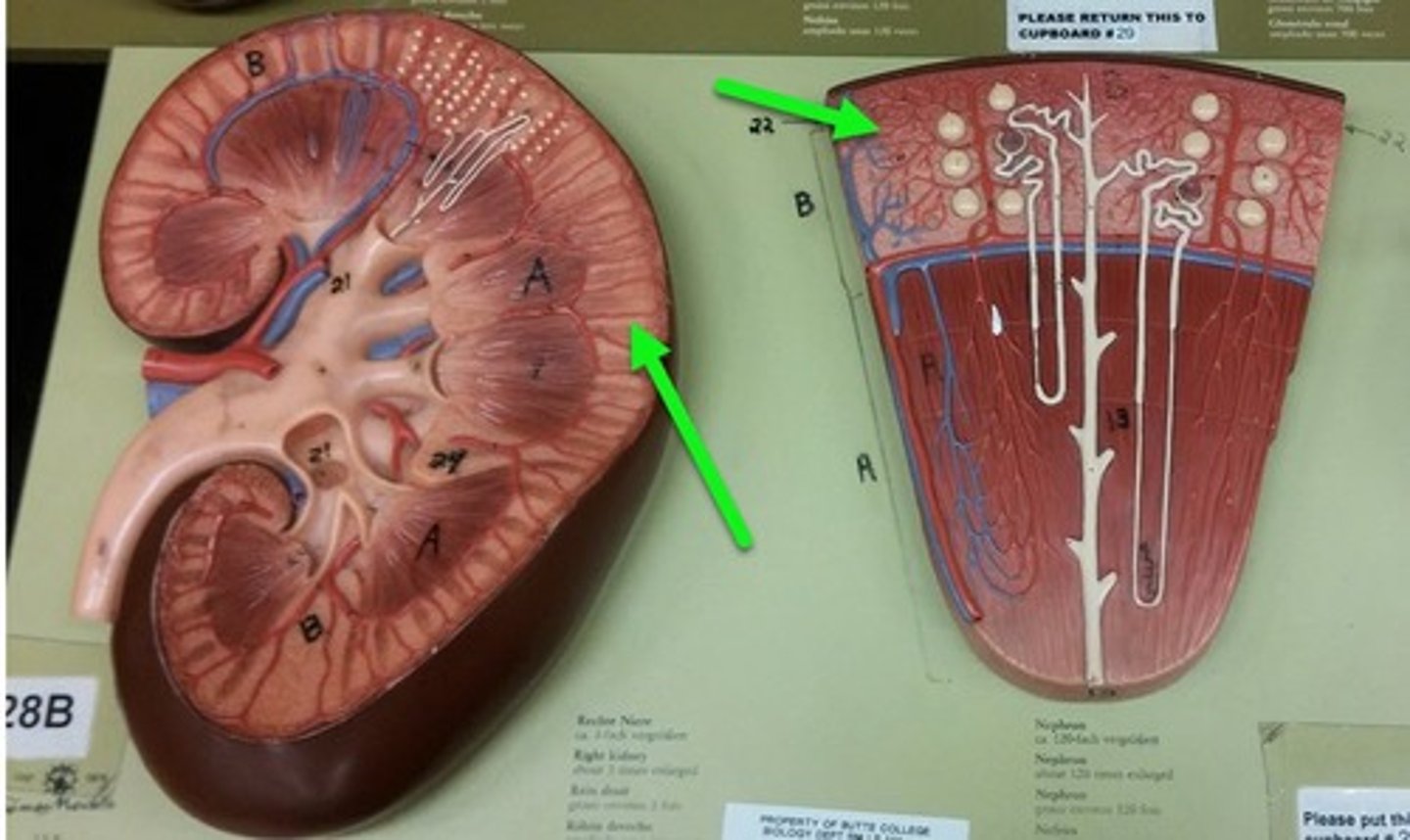 <p>region of lighter tissue</p>