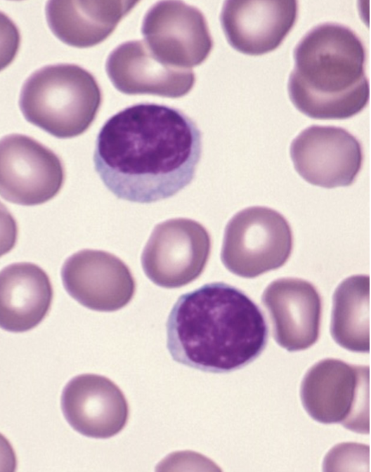 <p>what WBC is this?</p>