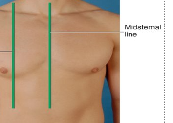 <p>bisects center of each clavicle </p>
