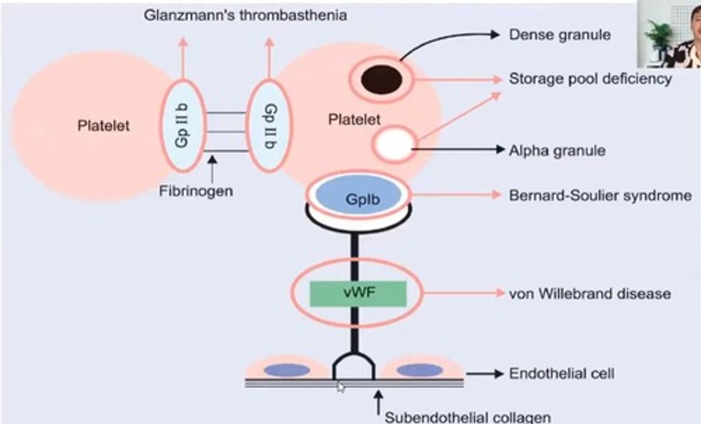 <p>Qualitative platelet disorder affecting adhesion.</p>
