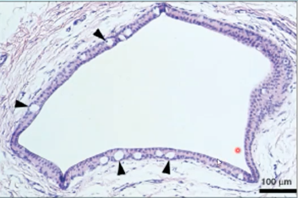 <p>what structure is shown here? </p>