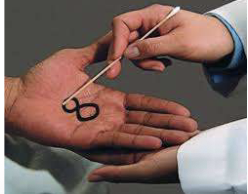 <p><span>what is Graphesthesia procedure?</span></p>