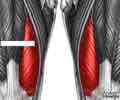 <p>Extends leg at the knee; part of the quadriceps group</p>