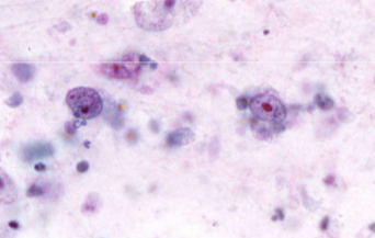 term image