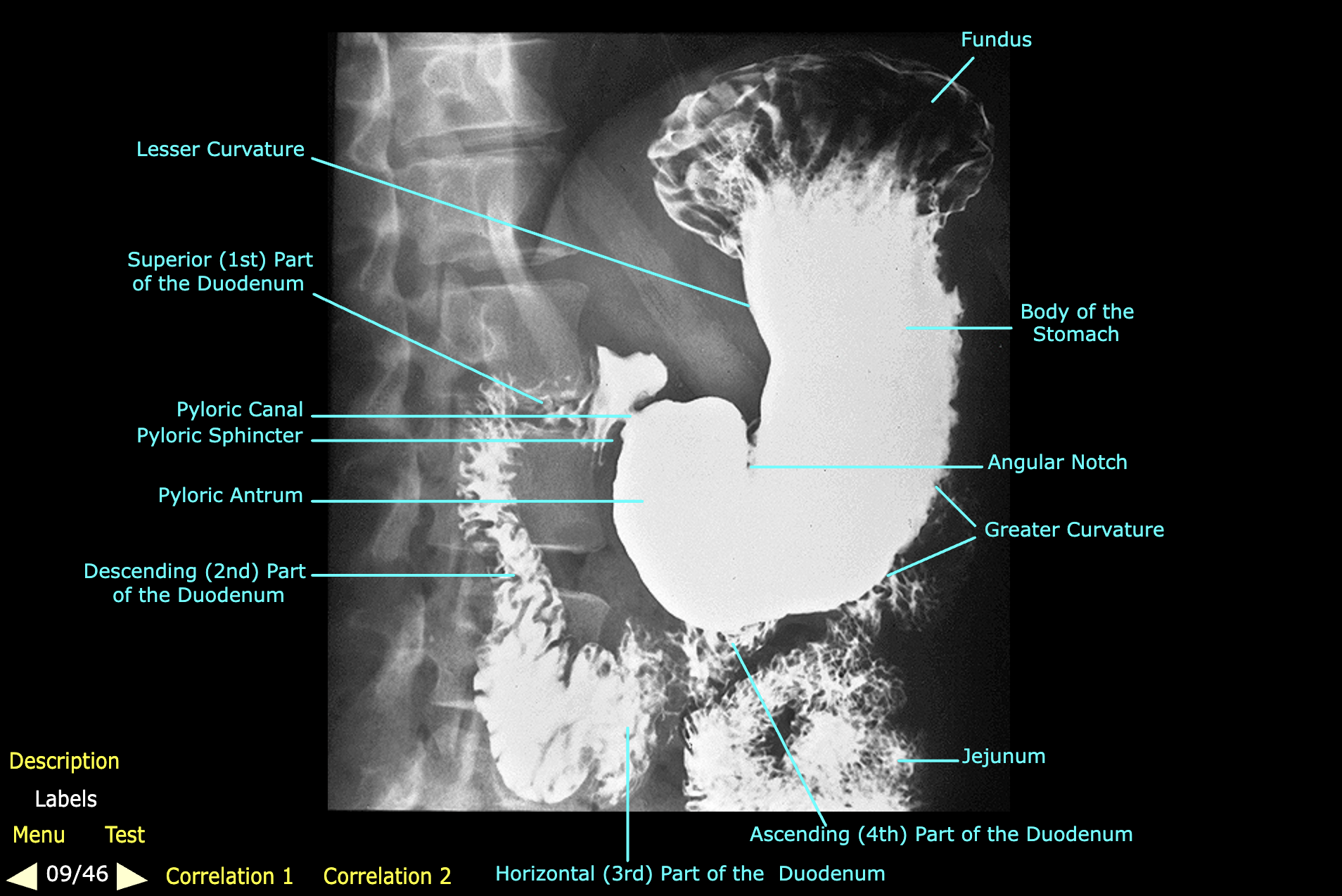 knowt flashcard image