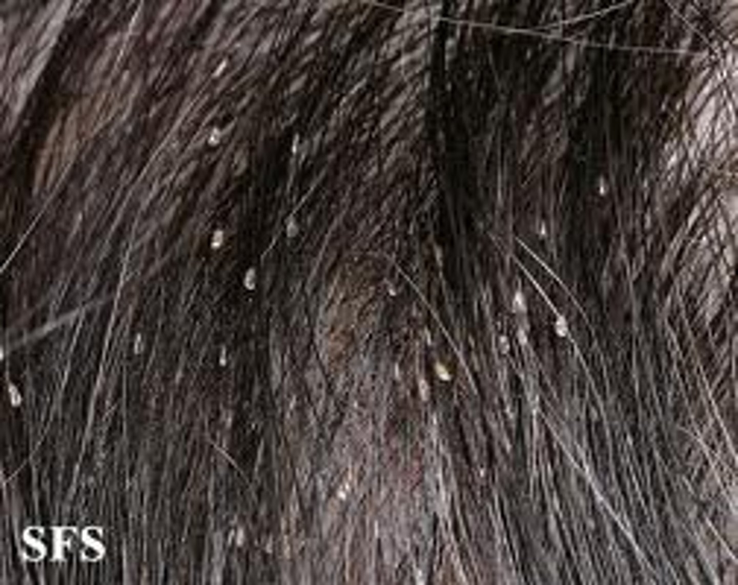 <p>lice; an insulting term for country folk</p>
