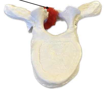 <p>What connect the spinous to the transverse process?</p>