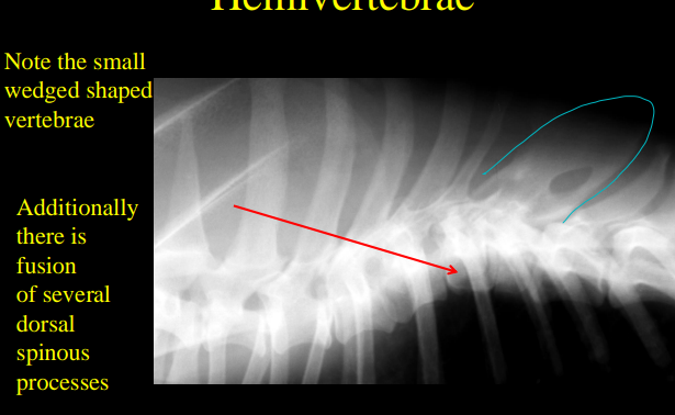 <ul><li><p><strong>Cause</strong></p><ul><li><p><strong>Congenital</strong></p></li><li><p>Bostons, bulldogs, pugs</p></li></ul></li><li><p><strong>CS</strong></p><ul><li><p><strong>incidental,</strong> stable</p></li></ul></li><li><p><strong>RS</strong></p><ul><li><p>Abnormally shaped or short vertebra, odd curvature of spine</p></li><li><p>50% less then other vertebra</p></li></ul></li></ul><p></p>