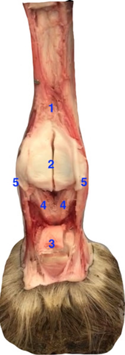 <p>sesamoidean ligaments- what is at 3?</p>