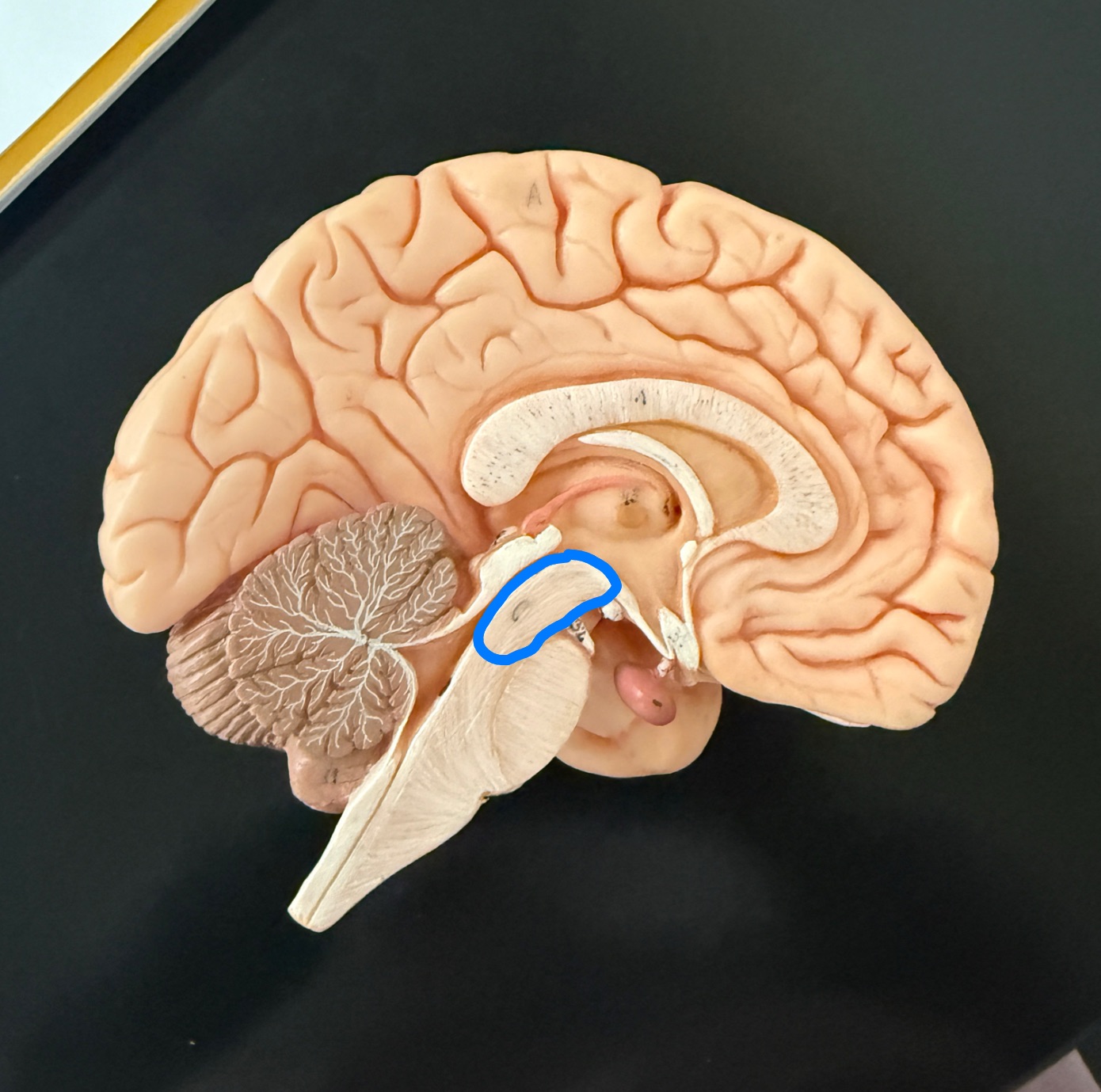 <p>What is outlined in blue on the brain model?</p>