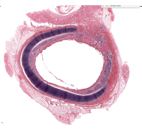 <p>What makes up the rings of the trachea?</p>
