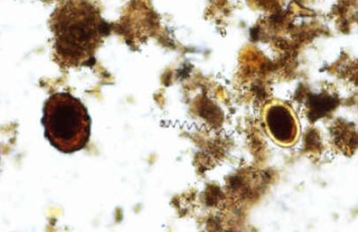 <p>Identify the parasite</p>