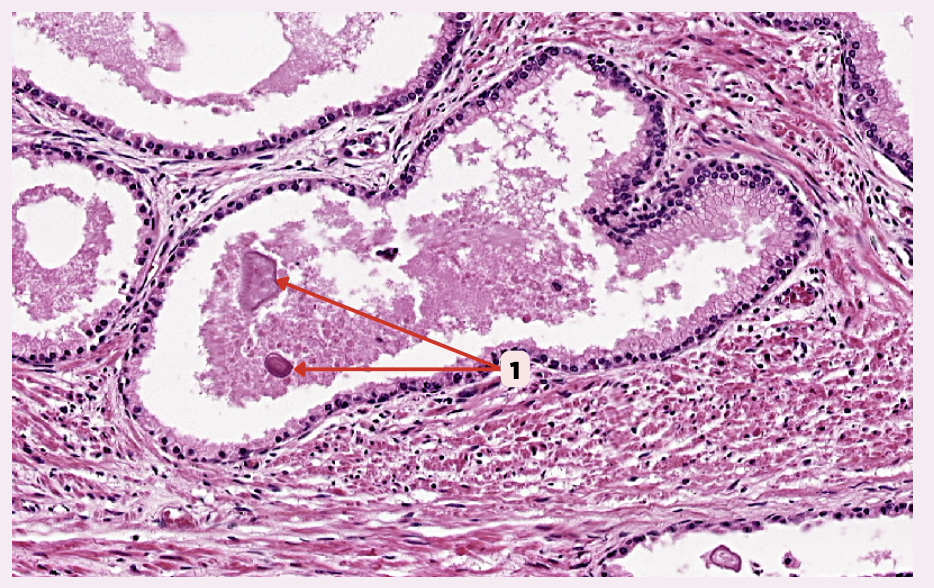 <p>Identify the structure labeled as 1.</p>