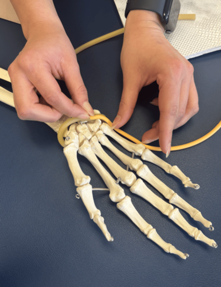 <p>What is this muscle?</p>