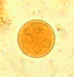 <p>Professor: Dr. Glena Fe A. Yapchulay-Alcabasa</p>