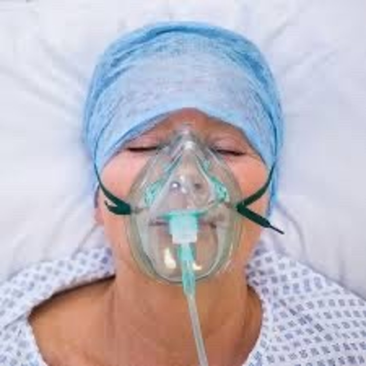 <p>- prevention is best - early stabilization (eg. reduction, immobilization) of fractures</p><p>- O2</p><p>- glucocorticoids</p>