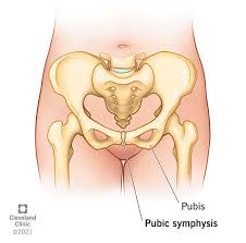 <p>Fibrocartilage ( pubic symphysis + vertebral body)</p>