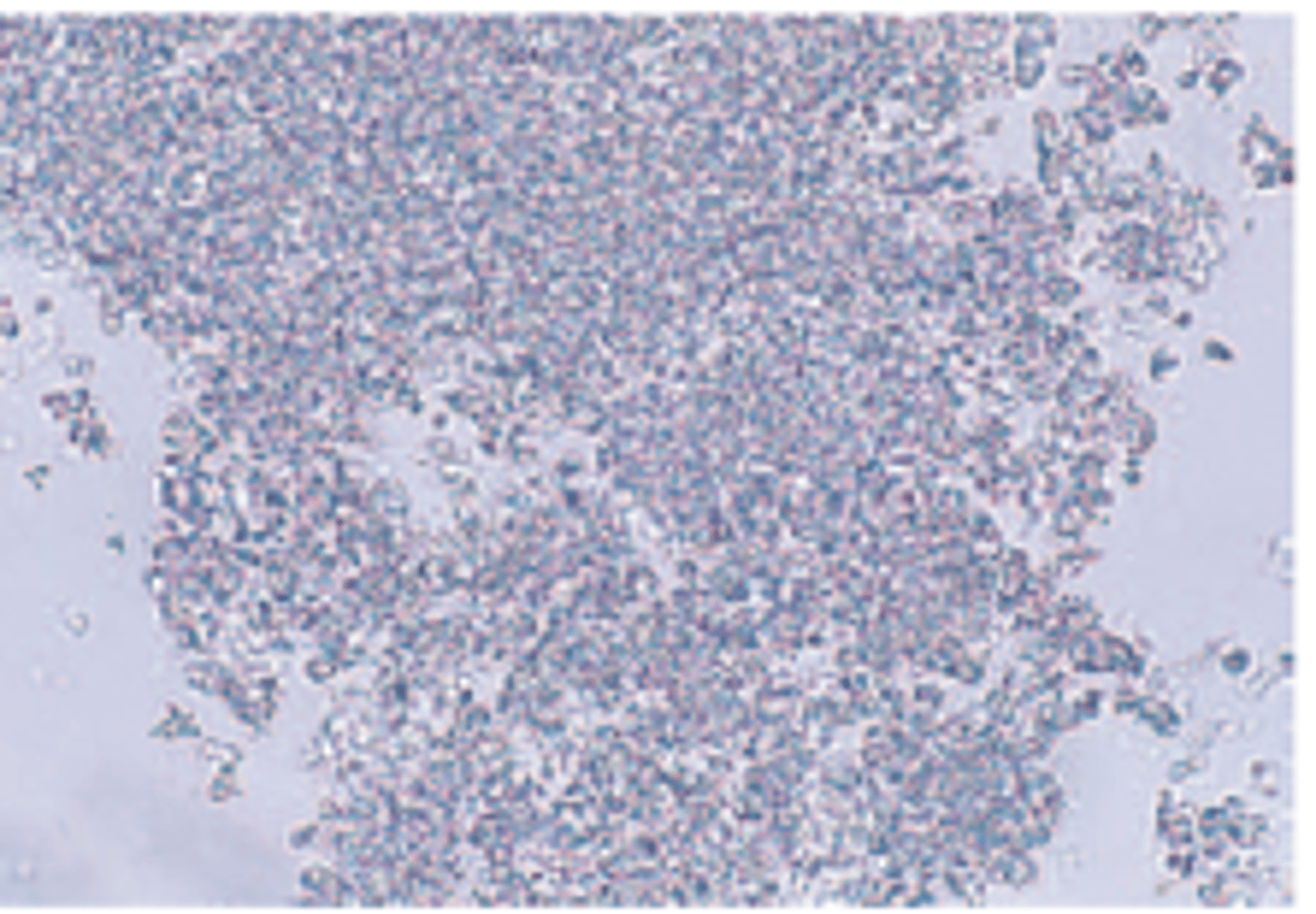 <p>granular preciptate appearance</p>
