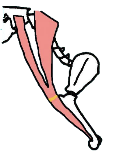 <p>** name hint: brachio = arm, cephalic = head</p><p></p><p><strong>Origin -</strong> Cervical vertebrae and skull</p><p><strong>Insertion -</strong> humerus</p><p><strong>Location -</strong> cranial to the limb; crosses over the shoulder joint</p><p></p><p>Is a <u>forearm</u><strong> PROTRACTOR,</strong> AND a<u> shoulder </u> <strong>EXTENSOR</strong></p><ul><li><p>Moves leg CRANIALLY in relation to trunk when contracted, while INCREASING the angle of the shoulder joint (extending the limb)</p></li></ul><p></p>