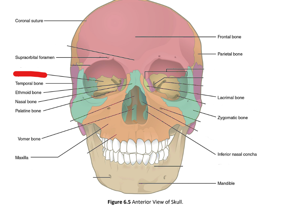 term image