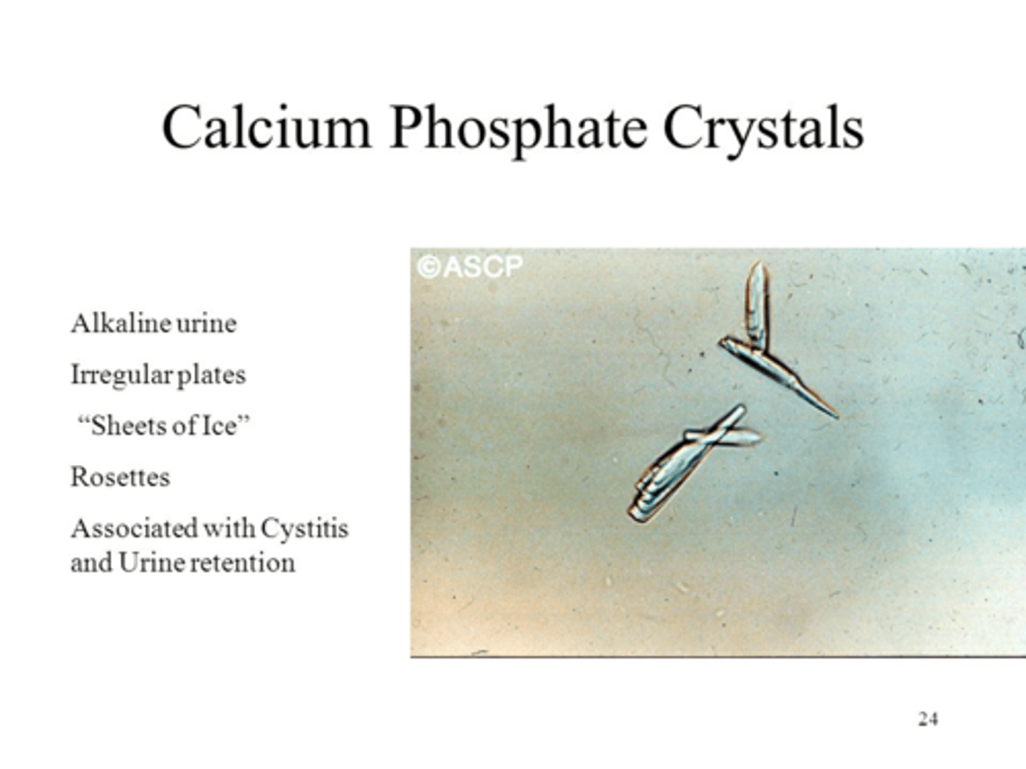 <p>Calcium Phosphate</p><p>-Only form seen in alkaline urine-</p>