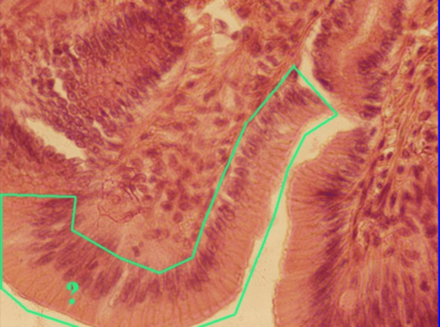 <p>Single layer of tall cells that have microvilli</p><p>Location: lining digestive tract</p><p>Function: Absorption and secretion (secretes mucins)</p>