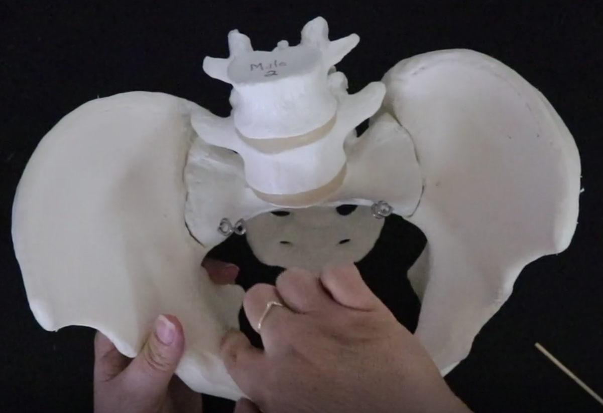 <p>separates the true and false pelvis</p><p></p><p>the brim she is circling with her finger</p><p></p><p>so above the brim: greater/false pelvis</p><p>below brim: true/lesser pelvis</p>