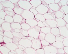 Also called fat tissue; specialized tissue that stores lipids