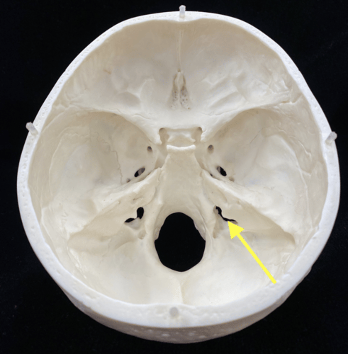 <p>name the bone feature</p>