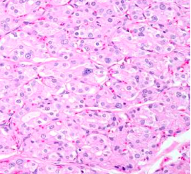 <p>What seems to be the pathology? what organ?</p>