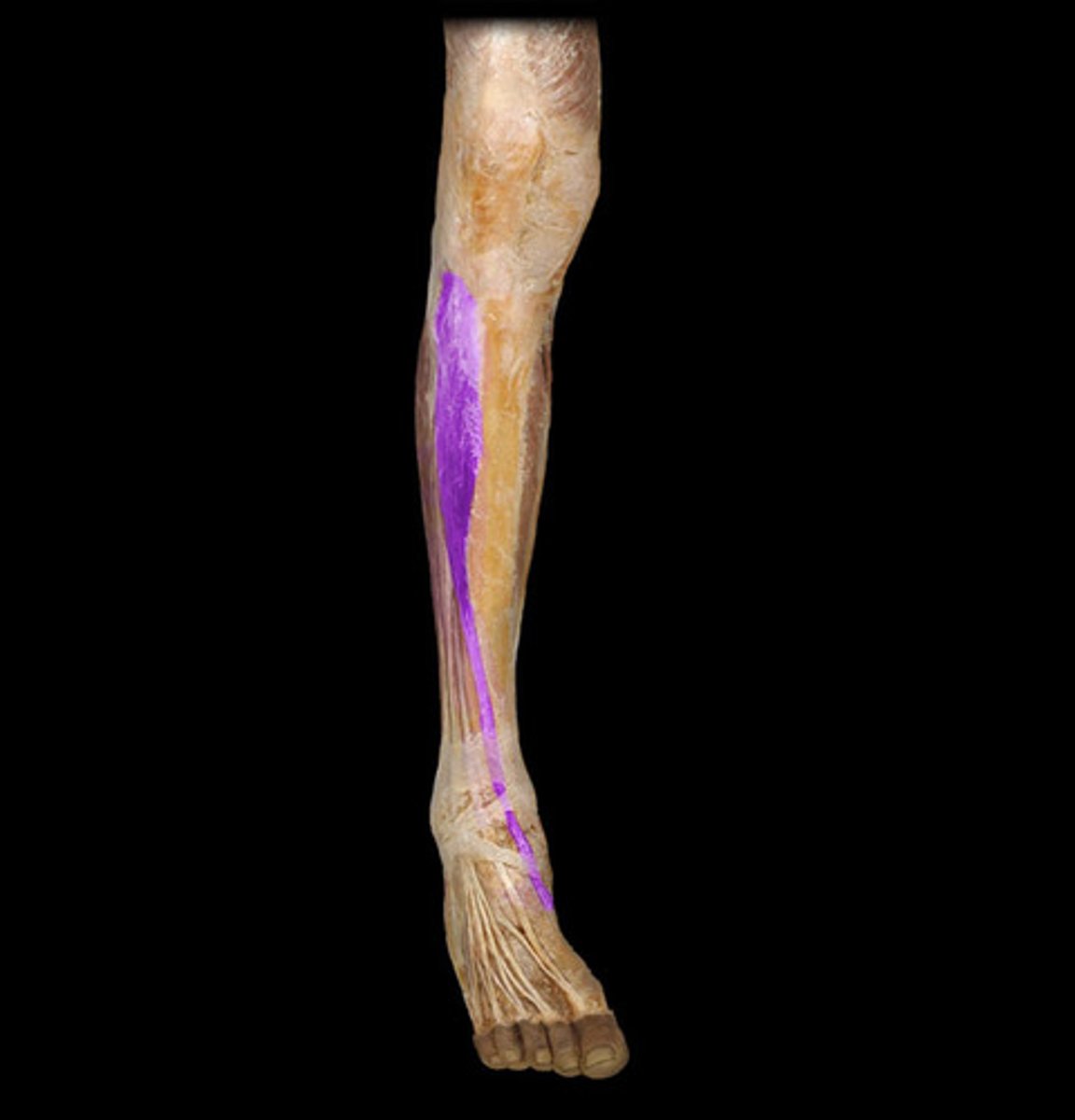 <p>Proximal attachment: Tibia (lateral condyle)</p><p>Distal attachment: Metatarsal 1 and cuneiform</p><p>Comments, Applications and Relationships: Inverts foot, implicated in shin splints.</p><p>Action: Dorsiflexor of the foot at the ankle</p>