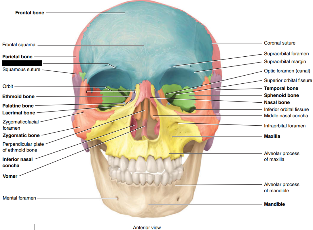 <p>State and identify which part of the cranial bone is being censored.</p>