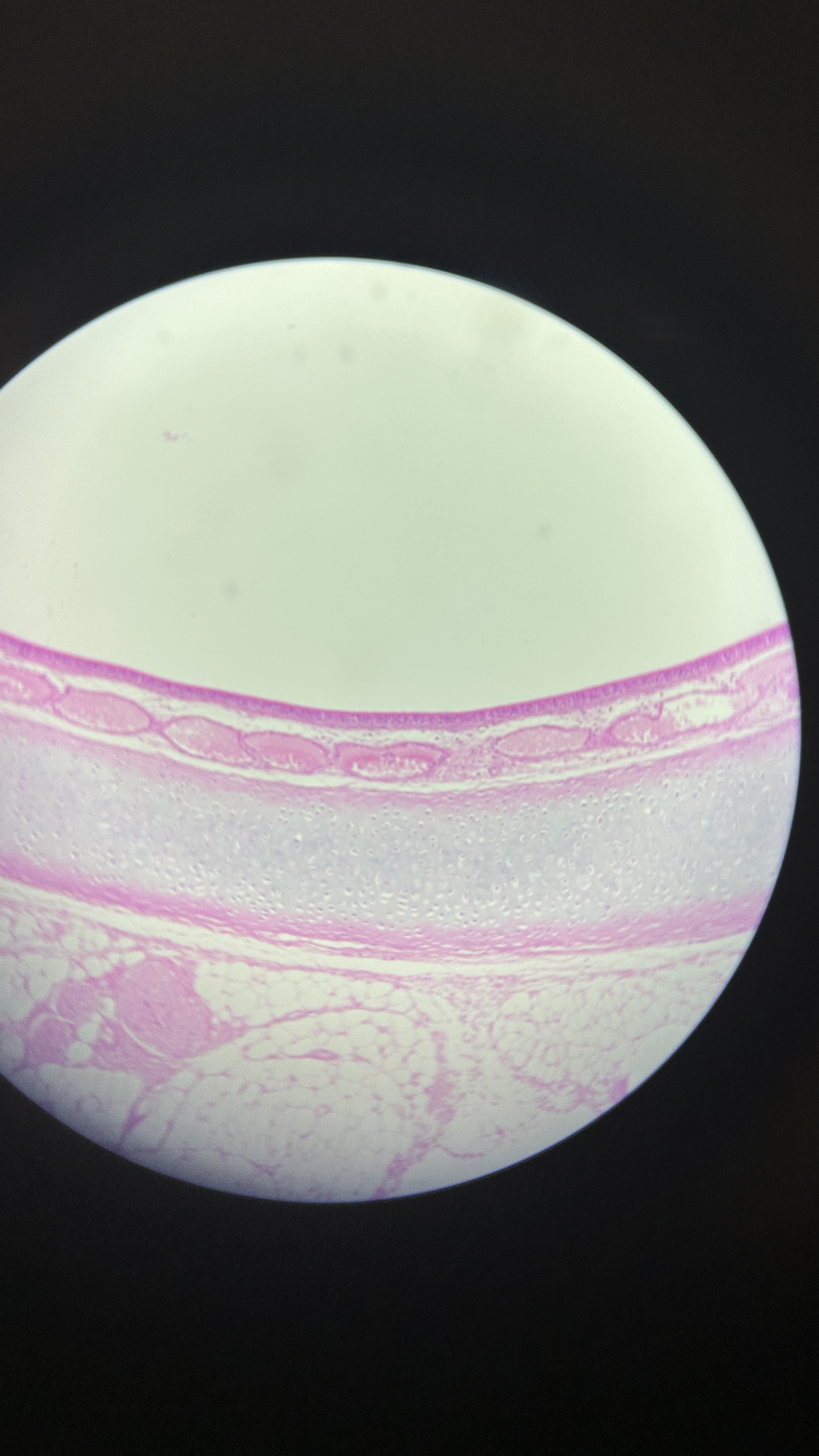 <p>What is the magnification level of the Hydraline Cartilage?</p>