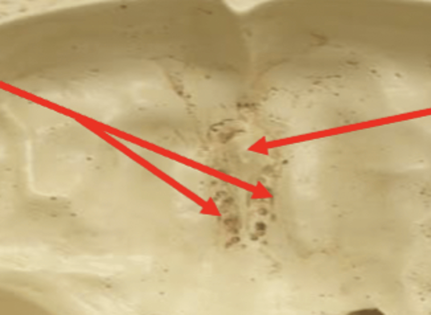 <p>ethmoid bone</p>