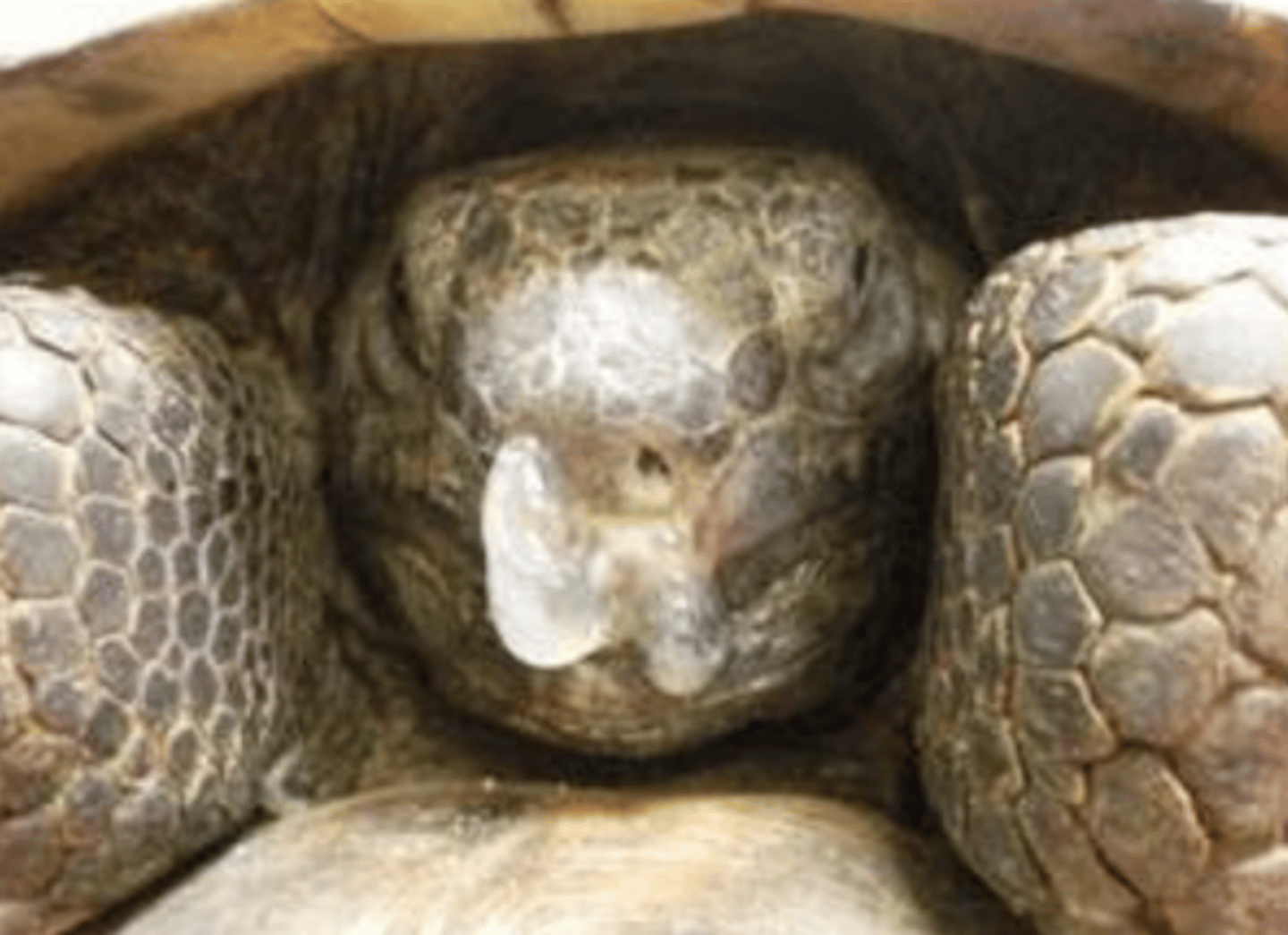 <p>what type of exudate is being depicted in the image?</p>