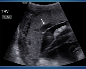 <p>what is the arrow pointing to?</p>