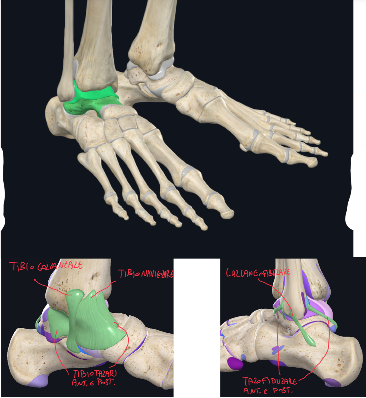 <p>E’ un articolazione sinoviale a ginglimo angolare. quindi permette solo movimenti di:</p><ul><li><p>Flessione dorsale (cioè estensione del piede)</p></li><li><p>Flessione plantare</p></li></ul><p>Superfici Articolari:</p><ul><li><p>Le superfici articolari di tibia e fibula che chiamiamo PINZA accolgono il corpo del talo</p></li><li><p>I lati della pinza rappresentano i malleoli che hanno le superfici articolari che si articolano con le superfici malleolari del talo</p></li><li><p>La superficie articolare del corpo del talo è anteriormente più larga, ciò significa che durante l’estensione del piede (flessione dorsale) l’articolazione è più stabile, rispetto la flessione plantare, dove posteriormente l’incastro è minore, infatti è qui che è più probabile una lussazione.</p></li></ul><p>LEGAMENTI ARTICOLAZIONE TALOCRURALE:</p><ul><li><p>Legamento Collaterale Mediale (più robusto):</p><ul><li><p>O Deltoideo per forma tirangolare </p></li><li><p>Dal malleolo mediale a talo, calcagno e navicolare. </p></li><li><p>Infatti è formato da 4 componenti che sono i legamenti tibiotalari anteriore e posteriore, tibiocalcaneale e tibionavicolare</p></li></ul></li><li><p>Legamento Collaterale Laterale (più debole):</p><ul><li><p>Tra malleolo laterale, talo e calcagno </p></li><li><p>Legamento talofibulare anteriore e posteriore, e calcaneofibulare.</p></li></ul></li></ul><p></p>