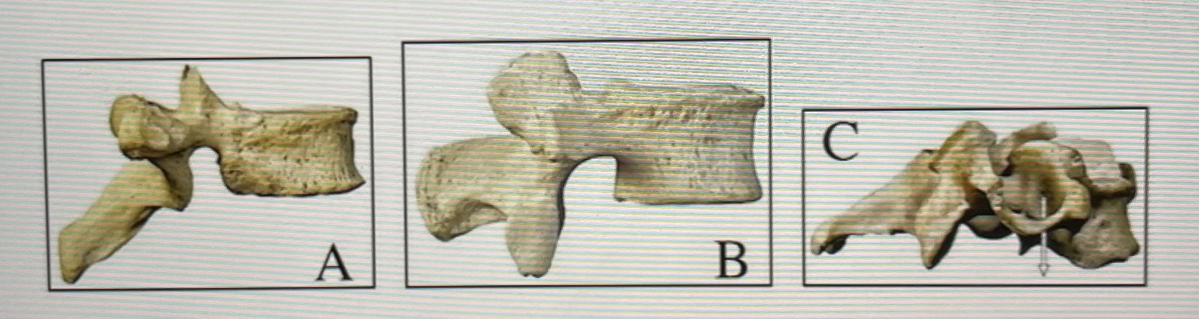 Based on the figure above identify each vertebrae 