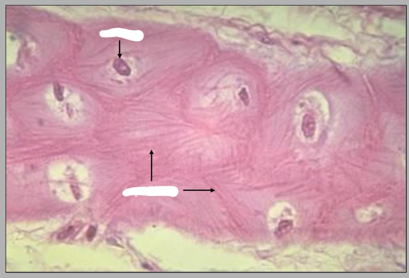 <p>This is another view of purkinje fibers in ovine heart. What are the parts seen in this slide?</p>