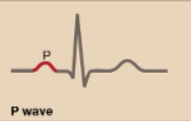 <p>P- Wave</p>