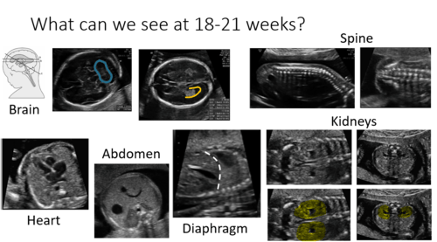 <p>The fetus is covered in lanugo, a peach fuzz-like hair. It helps keep the fetus warm and provides another layer of protection. The fetus may have a sleep-wake cycle, and loud noises may wake the fetus if it's asleep.</p>