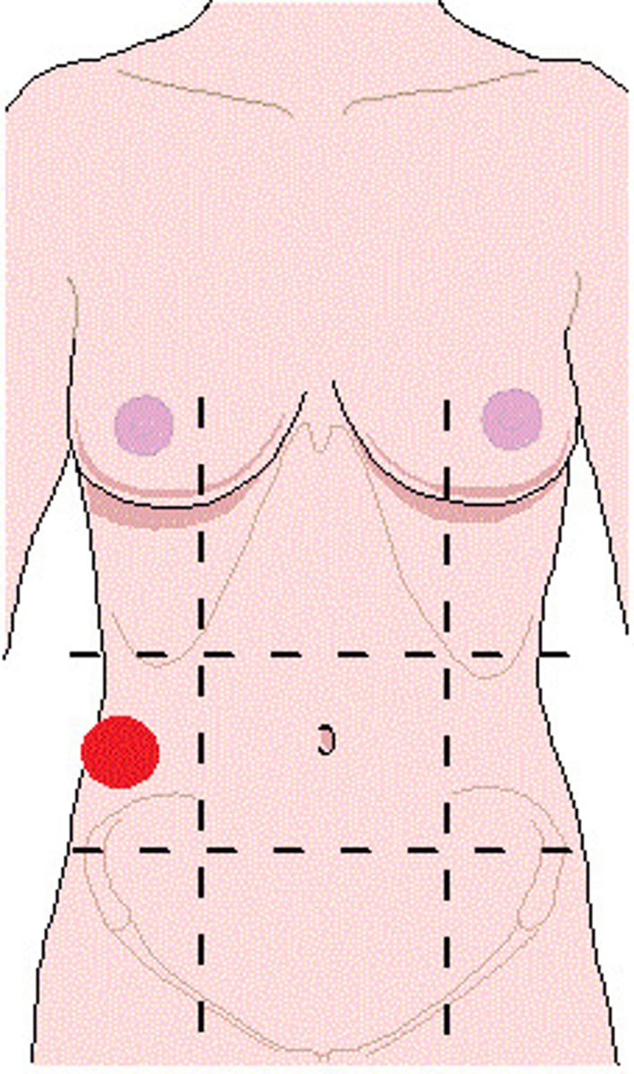 <p>region located in the middle-right section of the abdomen beneath the right hypochondriac region</p>