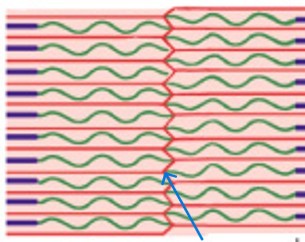 <p>Which part of the I-band is:</p><ul><li><p>Mark the boundary between adjacent sarcomeres</p></li></ul><p></p>
