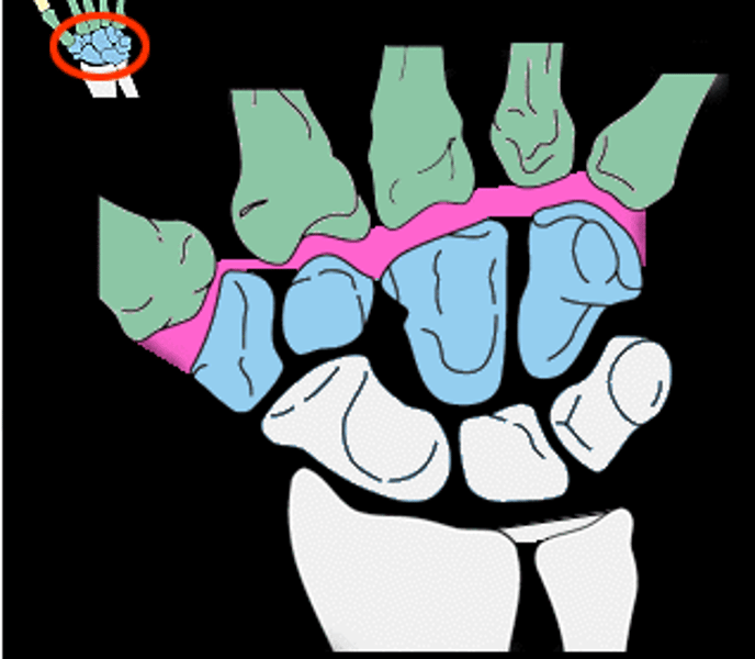 <p>Connects the metacarpals to the distal carpals</p>