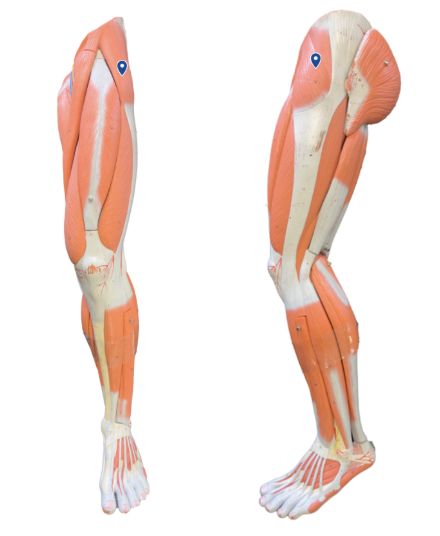 <p>What muscle is the arrow pointing to?</p>