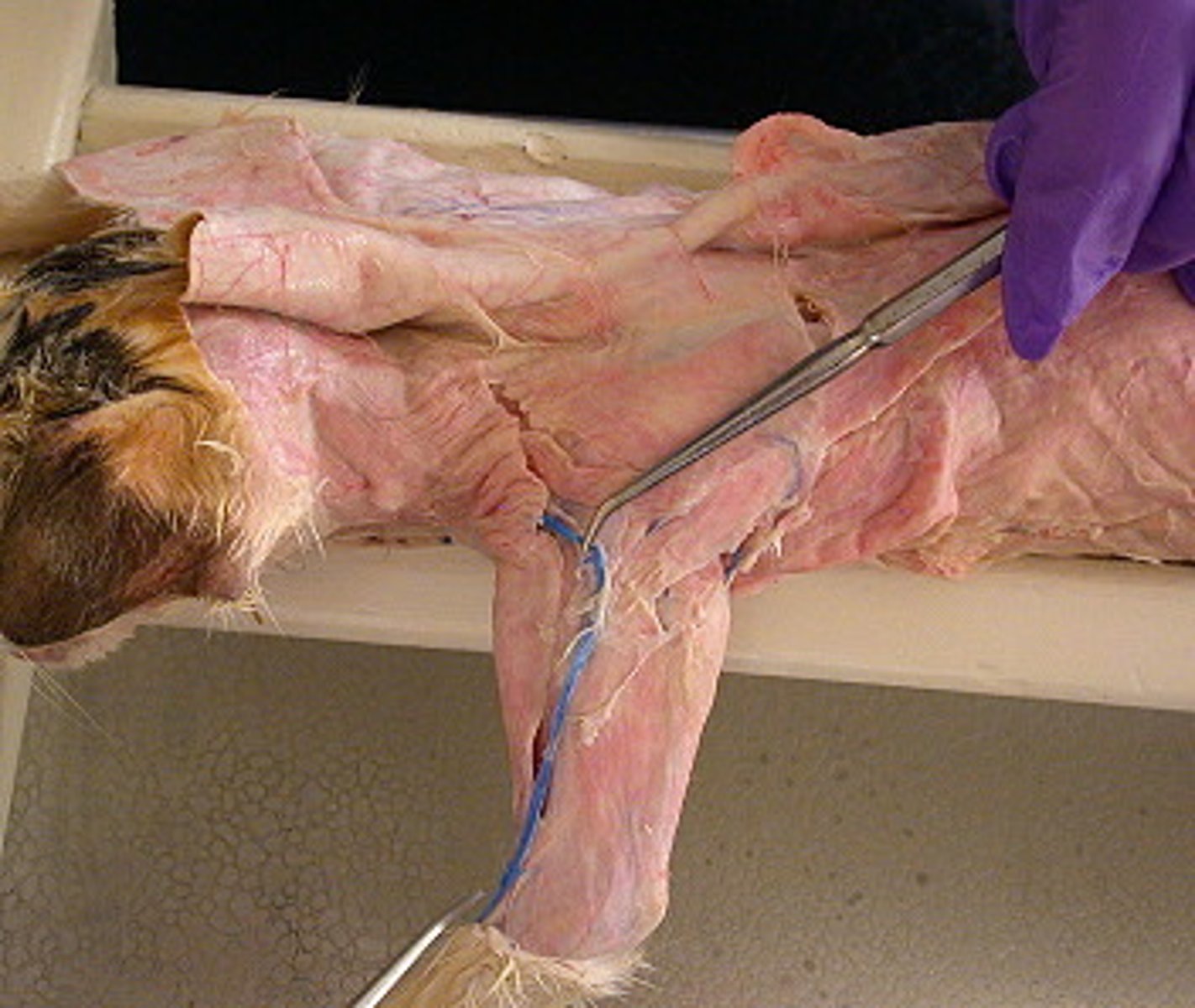 <p>Large vein on the outermost side of the upper arm</p>