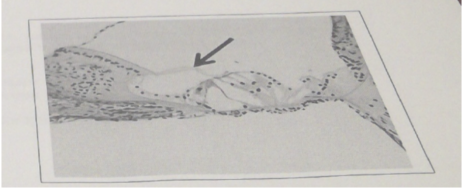 33\. The structure indicated by the arrow