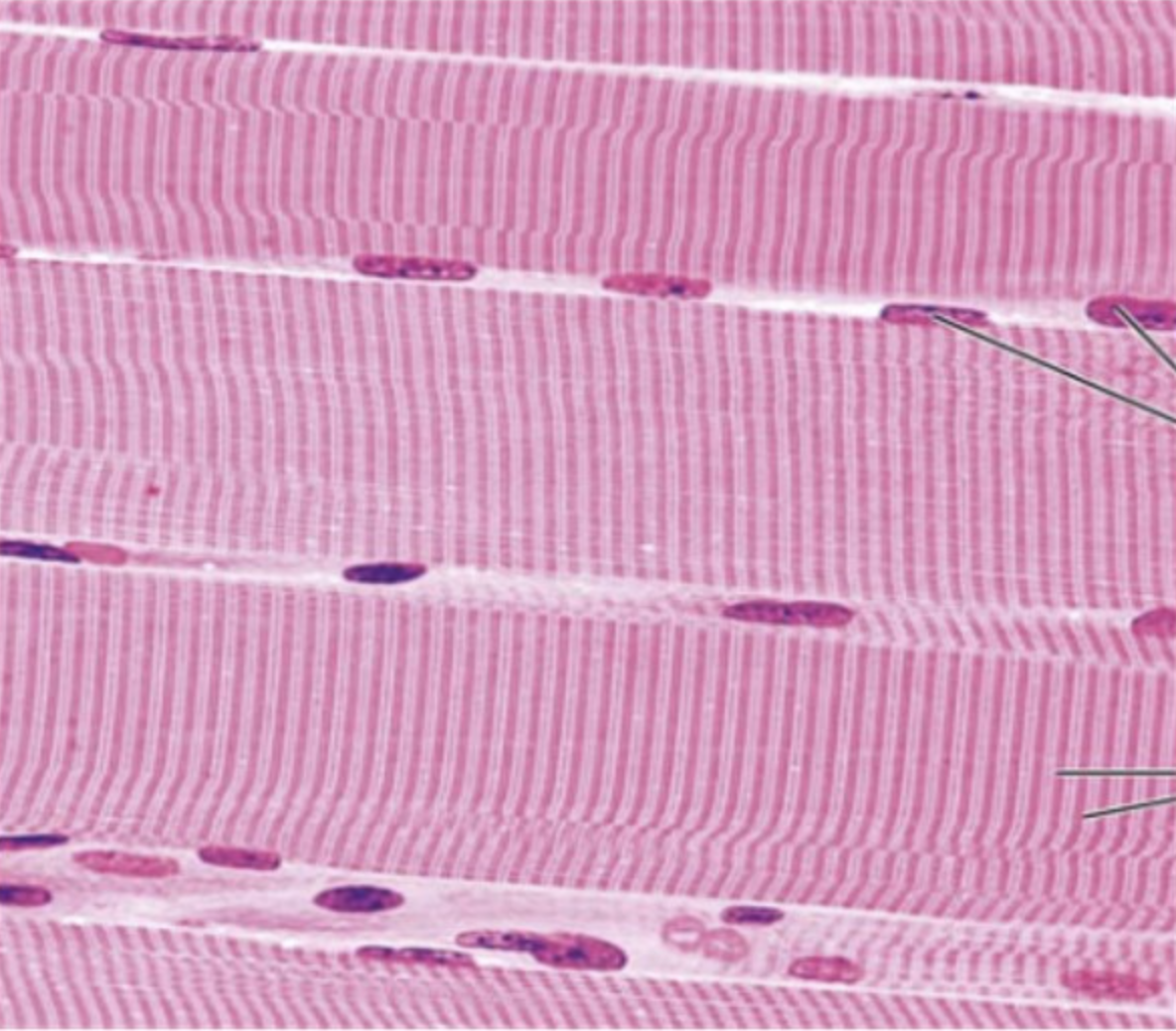 <p>What type of tissue is this? </p>