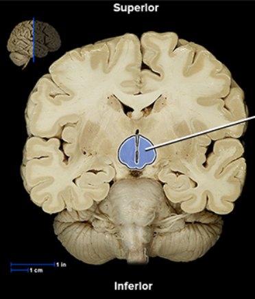 <p><span><span>Hypothalamus</span></span></p>